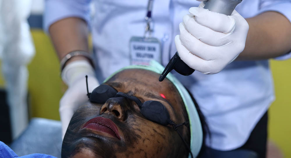 Best Carbon Laser Treatment