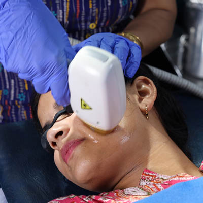 Laser Hair Reduction Treatment in Meerut